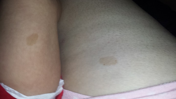 Mommy & Michael Same Birth Mark