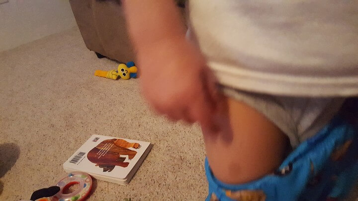 My Birth Mark