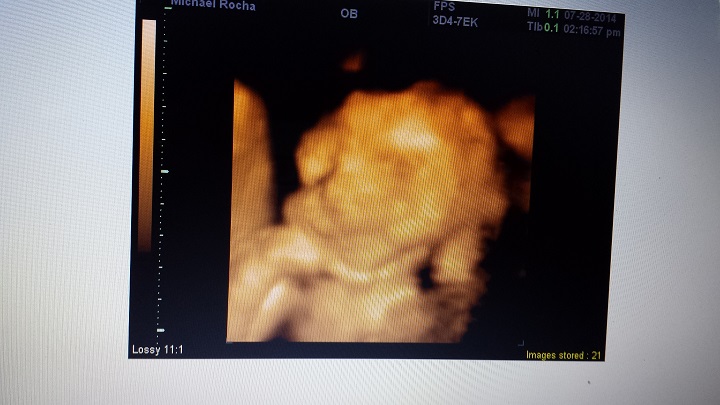 Bun In The Oven